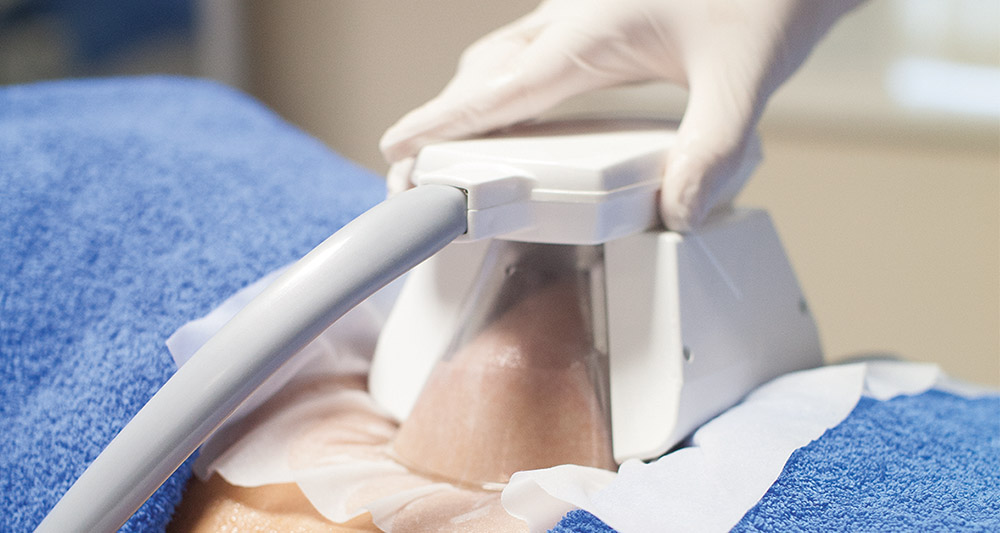 How Fat Freezing and HIFU Work Together? 2 Multiple Areas in One Session HIFU and Fat Freezing Addlestone